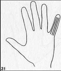 immagine che rappresenta una mano in cui è evidenziato il dito mignolo